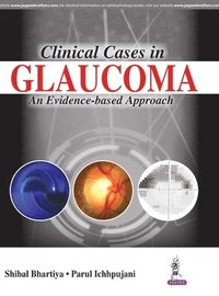bokomslag Clinical Cases in Glaucoma