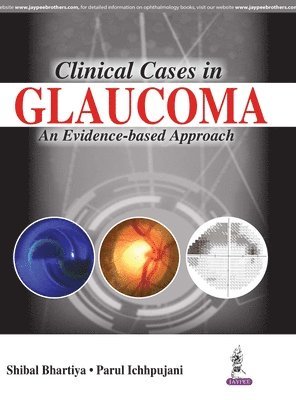 Clinical Cases in Glaucoma 1
