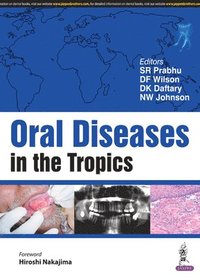 bokomslag Oral Diseases in the Tropics