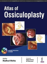bokomslag Atlas of Ossiculoplasty