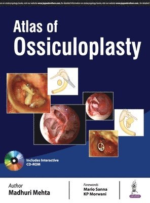 bokomslag Atlas of Ossiculoplasty