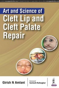 bokomslag Art and Science of Cleft Lip and Cleft Palate Repair