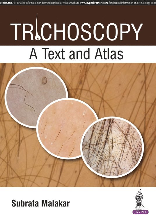 Trichoscopy 1