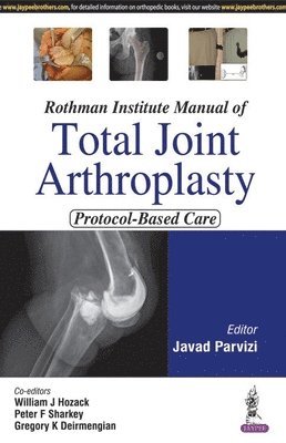 Rothman Institute Manual of Total Joint Arthroplasty 1