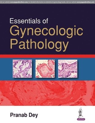 bokomslag Essentials of Gynecologic Pathology
