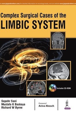 Sepehr Sani, Mustafa K Baskaya, Richard W Byrne - Complex Surgical Cases of the Limbic System, Inbunden