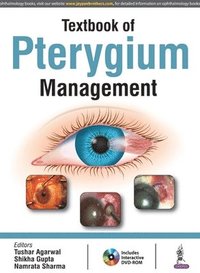 bokomslag Textbook of Pterygium Management