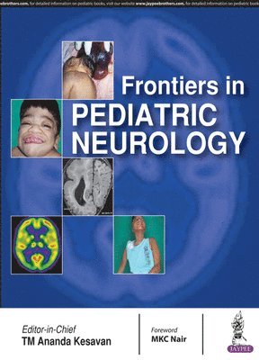 bokomslag Frontiers in Pediatric Neurology