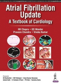 bokomslag Atrial Fibrillation Update: A Textbook of Cardiology