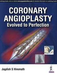 bokomslag Coronary Angioplasty