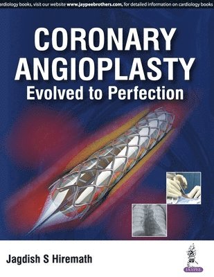 bokomslag Coronary Angioplasty