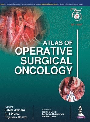 Sabita Jiwnani, Anil D'cruz, Rajendra Badwe - Atlas of Operative Surgical Oncology, Inbunden
