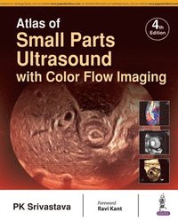 bokomslag Atlas of Small Parts Ultrasound