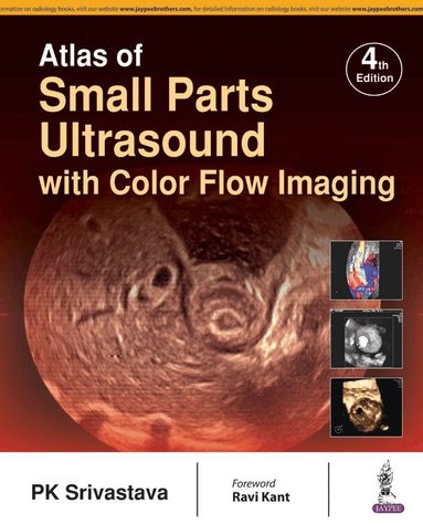 PK Srivastava - Atlas of Small Parts Ultrasound, Inbunden