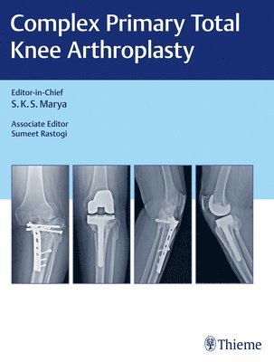 bokomslag Complex Primary Total Knee Arthroplasty