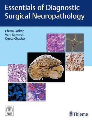 Chitra Sarkar, Vani Santosh, Geeta Chacko, Anita Mahadevan - Essentials of Diagnostic Surgical Neuropathology, Inbunden