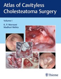 bokomslag Atlas of Cavityless Cholesteatoma Surgery, Vol 1