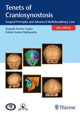 Deepak Gupta, Ashok Mahapatra - Tenets of Craniosynostosis, Inbunden