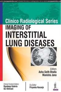 bokomslag Clinico Radiological Series: Imaging of Interstitial Lung Diseases