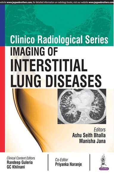 Ashu Seith Bhalla, Manisha Jana - Clinico Radiological Series: Imaging of Interstitial Lung Diseases, Häftad