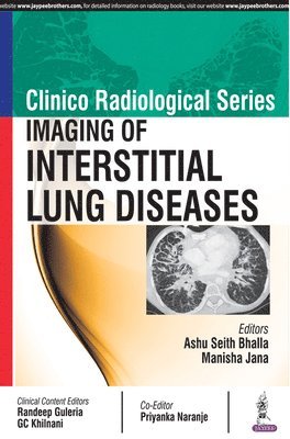bokomslag Clinico Radiological Series: Imaging of Interstitial Lung Diseases