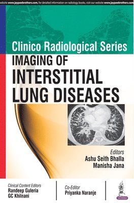 Clinico Radiological Series: Imaging of Interstitial Lung Diseases 1