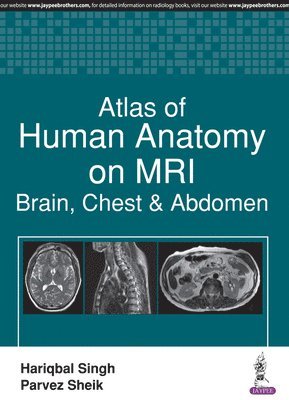 bokomslag Atlas of Human Anatomy on MRI