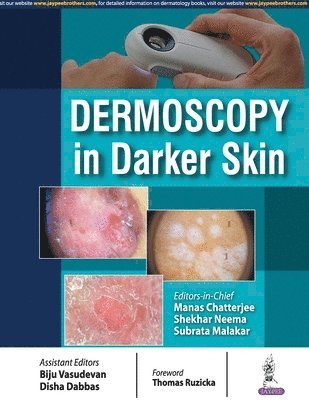 bokomslag Dermoscopy in Darker Skin