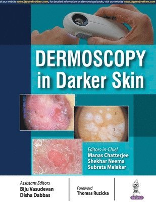 Manas Chatterjee, Shekhar Neema, Subrata Malakar, Neema Shekhar - Dermoscopy in Darker Skin, Häftad
