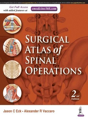 bokomslag Surgical Atlas of Spinal Operations