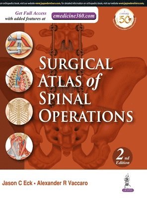 Surgical Atlas of Spinal Operations 1