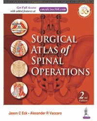 Surgical Atlas of Spinal Operations 1