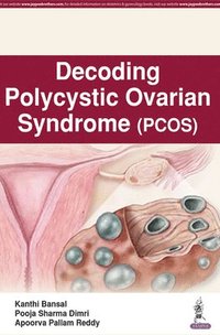 bokomslag Decoding Polycystic Ovarian Syndrome