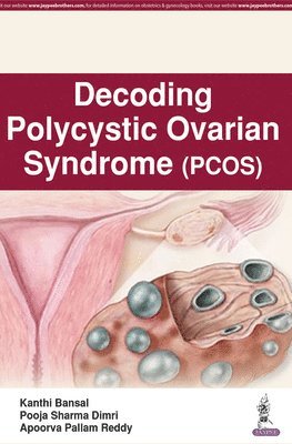 bokomslag Decoding Polycystic Ovarian Syndrome