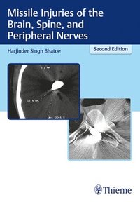 bokomslag Missile Injuries Of The Brain, Spine, And Peripheral Nerves