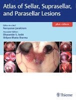 bokomslag Atlas Of Sellar, Suprasellar, And Parasellar Lesions