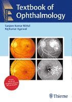 Textbook of Ophthalmology 1