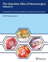 bokomslag The Operative Atlas of Neurosurgery, Vol II