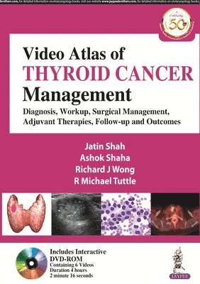 bokomslag Video Atlas of Thyroid Cancer Management