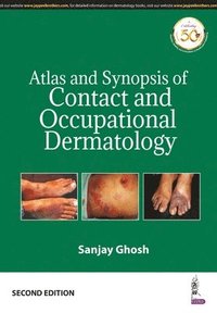 bokomslag Atlas and Synopsis of Contact and Occupational Dermatology