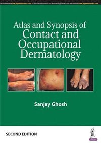 bokomslag Atlas and Synopsis of Contact and Occupational Dermatology