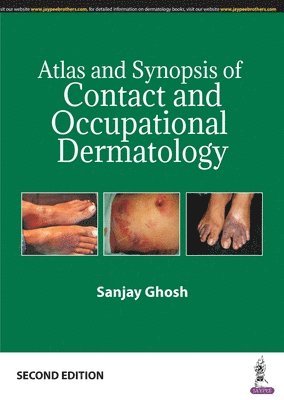Sanjay Ghosh - Atlas and Synopsis of Contact and Occupational Dermatology, Häftad
