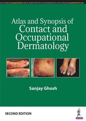 Atlas and Synopsis of Contact and Occupational Dermatology 1