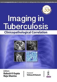 bokomslag Imaging in Tuberculosis