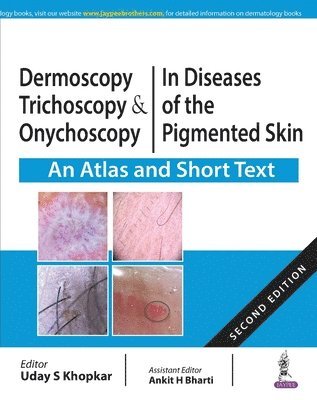 Uday Khopkar, Ankit Bharti - Dermoscopy, Trichoscopy and Onychoscopy in Diseases of the Pigmented Skin, Häftad