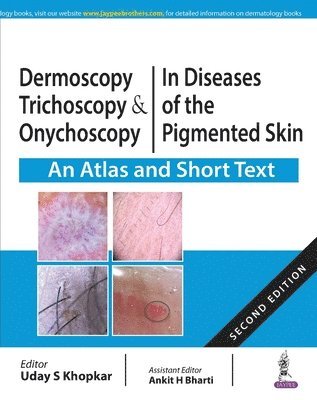 Dermoscopy, Trichoscopy and Onychoscopy in Diseases of the Pigmented Skin 1