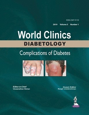 Viswanathan Mohan - World Clinics Diabetology: Complications of Diabetes, Inbunden