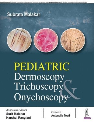 bokomslag Pediatric Dermoscopy Trichoscopy & Onychoscopy