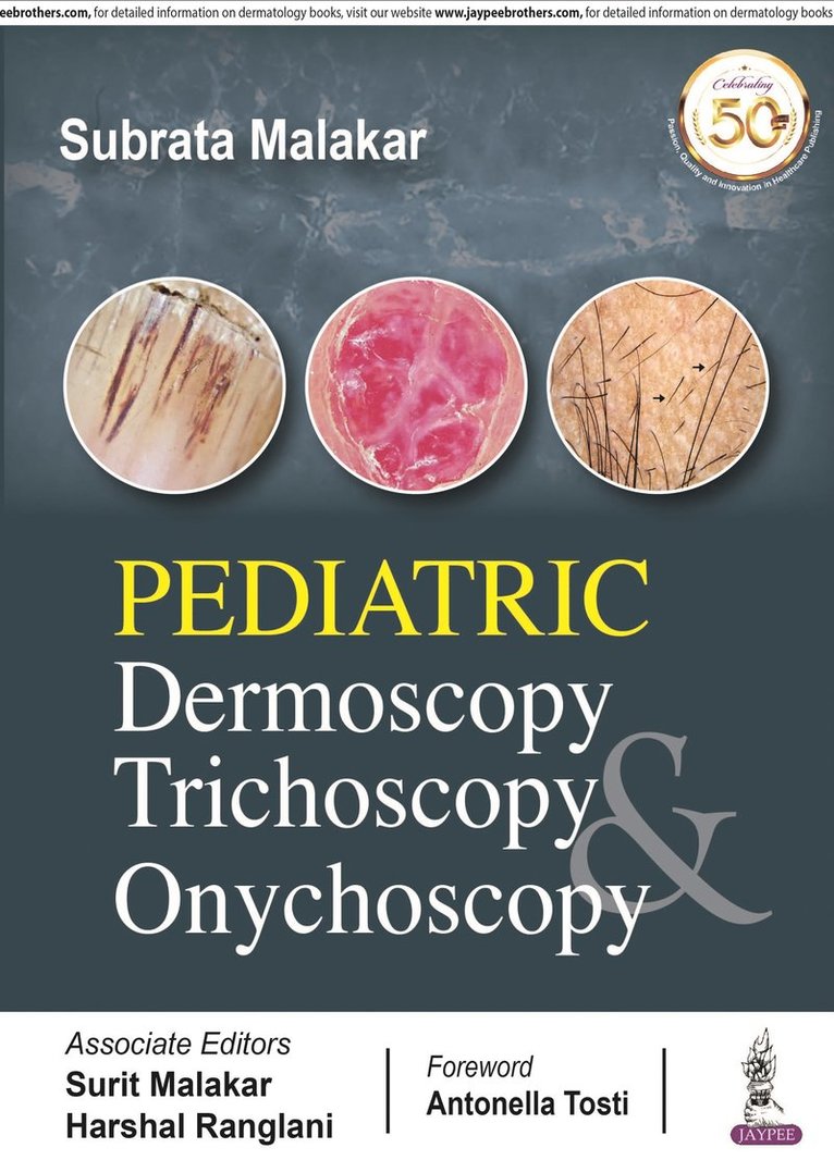Subrata Malakar - Pediatric Dermoscopy Trichoscopy & Onychoscopy, Häftad