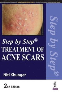 bokomslag Step by Step Treatment of Acne Scars